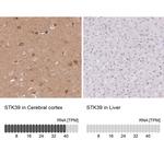 STK39 Antibody in Immunohistochemistry (Paraffin) (IHC (P))