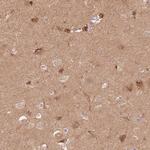 STK39 Antibody in Immunohistochemistry (Paraffin) (IHC (P))