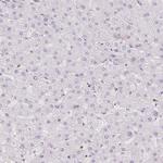 STK39 Antibody in Immunohistochemistry (Paraffin) (IHC (P))