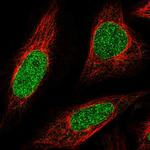 ABCA5 Antibody in Immunocytochemistry (ICC/IF)