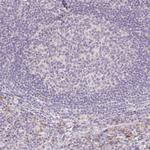 ACVR1B Antibody in Immunohistochemistry (Paraffin) (IHC (P))