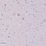 MMP9 Antibody in Immunohistochemistry (Paraffin) (IHC (P))