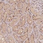 MAPKAPK2 Antibody in Immunohistochemistry (Paraffin) (IHC (P))