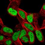 SMARCA1 Antibody in Immunocytochemistry (ICC/IF)