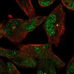 NEK2 Antibody in Immunocytochemistry (ICC/IF)