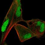 PP1 beta Antibody in Immunocytochemistry (ICC/IF)