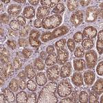 PP1 beta Antibody in Immunohistochemistry (Paraffin) (IHC (P))