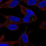 SPHK2 Antibody in Immunocytochemistry (ICC/IF)