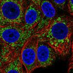 CCM2 Antibody in Immunocytochemistry (ICC/IF)