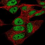 CPSF4 Antibody in Immunocytochemistry (ICC/IF)