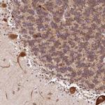 GP6 Antibody in Immunohistochemistry (Paraffin) (IHC (P))