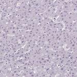 GP6 Antibody in Immunohistochemistry (Paraffin) (IHC (P))