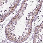 GP6 Antibody in Immunohistochemistry (Paraffin) (IHC (P))