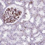 CD105 Antibody in Immunohistochemistry (Paraffin) (IHC (P))