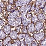 CD105 Antibody in Immunohistochemistry (Paraffin) (IHC (P))