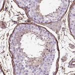 CD105 Antibody in Immunohistochemistry (Paraffin) (IHC (P))