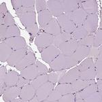 IL31RA Antibody in Immunohistochemistry (Paraffin) (IHC (P))