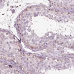 IL31RA Antibody in Immunohistochemistry (Paraffin) (IHC (P))