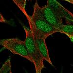 BAALC Antibody in Immunocytochemistry (ICC/IF)