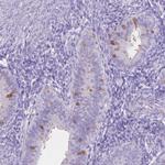 MMP11 Antibody in Immunohistochemistry (Paraffin) (IHC (P))