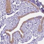 MMP11 Antibody in Immunohistochemistry (Paraffin) (IHC (P))