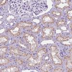 MMP11 Antibody in Immunohistochemistry (Paraffin) (IHC (P))