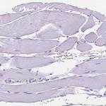 MMP11 Antibody in Immunohistochemistry (Paraffin) (IHC (P))