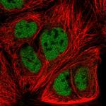 FZD7 Antibody in Immunocytochemistry (ICC/IF)