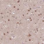 FZD7 Antibody in Immunohistochemistry (Paraffin) (IHC (P))