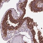 FZD7 Antibody in Immunohistochemistry (Paraffin) (IHC (P))