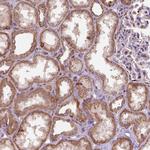 FZD7 Antibody in Immunohistochemistry (Paraffin) (IHC (P))