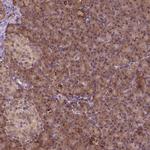 FZD7 Antibody in Immunohistochemistry (Paraffin) (IHC (P))