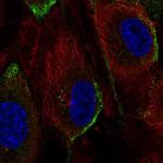 PIK3CG Antibody in Immunocytochemistry (ICC/IF)