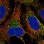 Dopamine beta Hydroxylase Antibody in Immunocytochemistry (ICC/IF)