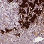 Dopamine beta Hydroxylase Antibody in Immunohistochemistry (Paraffin) (IHC (P))