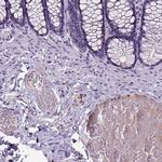 Dopamine beta Hydroxylase Antibody in Immunohistochemistry (Paraffin) (IHC (P))