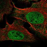 SETDB2 Antibody in Immunocytochemistry (ICC/IF)