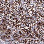 SR-BI Antibody in Immunohistochemistry (Paraffin) (IHC (P))