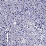 SR-BI Antibody in Immunohistochemistry (Paraffin) (IHC (P))