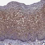 TRIP10 Antibody in Immunohistochemistry (Paraffin) (IHC (P))