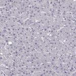 LRP8 Antibody in Immunohistochemistry (Paraffin) (IHC (P))