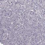 LRP8 Antibody in Immunohistochemistry (Paraffin) (IHC (P))