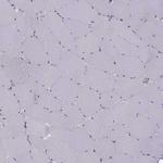 LRP8 Antibody in Immunohistochemistry (Paraffin) (IHC (P))