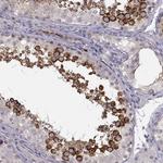 LRP8 Antibody in Immunohistochemistry (Paraffin) (IHC (P))