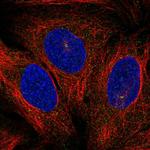 PKC theta Antibody in Immunocytochemistry (ICC/IF)