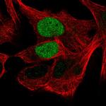 OCT6 Antibody in Immunocytochemistry (ICC/IF)