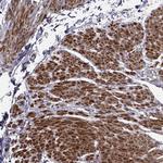 TRIP10 Antibody in Immunohistochemistry (Paraffin) (IHC (P))