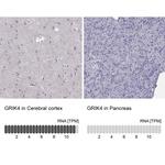 GRIK4 Antibody in Immunohistochemistry (Paraffin) (IHC (P))