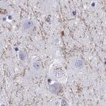 GRIK4 Antibody in Immunohistochemistry (Paraffin) (IHC (P))