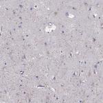 GRIK4 Antibody in Immunohistochemistry (Paraffin) (IHC (P))